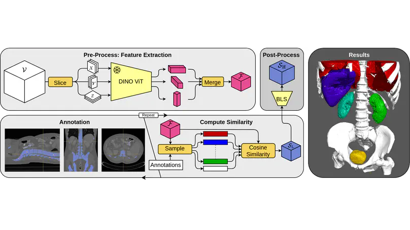 Leveraging Self-Supervised Vision Transformers for Segmentation-based Transfer Function Design